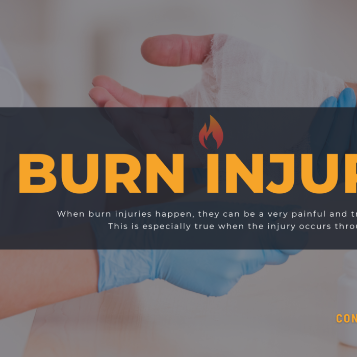 Burn Injuries Lawyers in New York