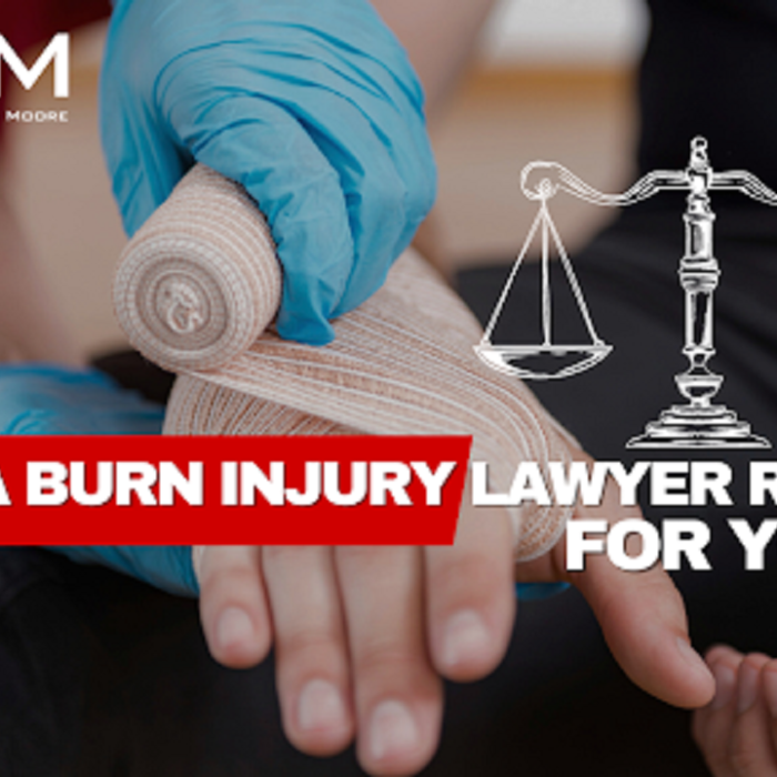 Is a Burn Injury Lawyer Right for You?