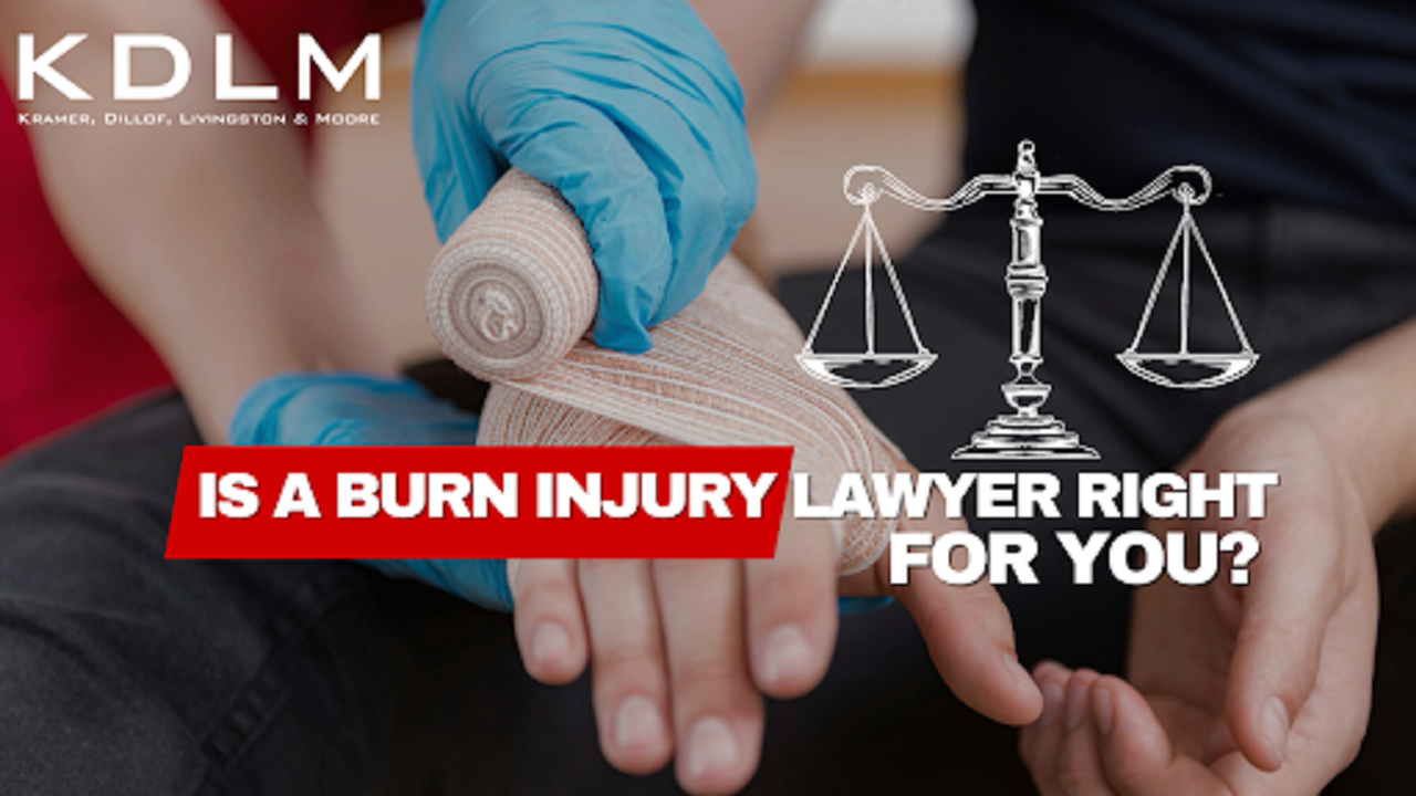 Is a Burn Injury Lawyer Right for You?