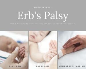 Babies Erb's Palsy