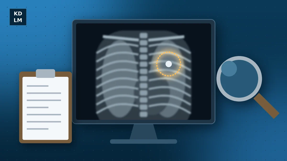 Chest X-ray on a monitor with a small spot in the lung circled, illustrating a delayed cancer diagnosis