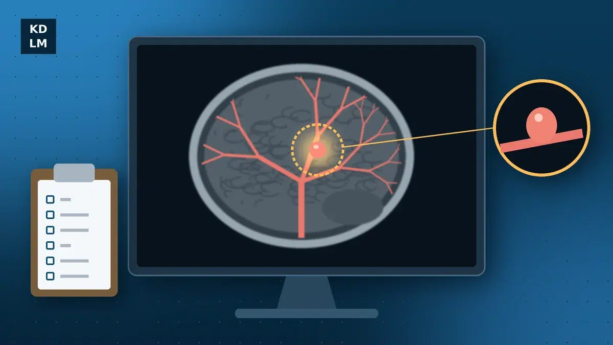 Brain scan with a bulging artery circled, illustrating a missed brain aneurysm
